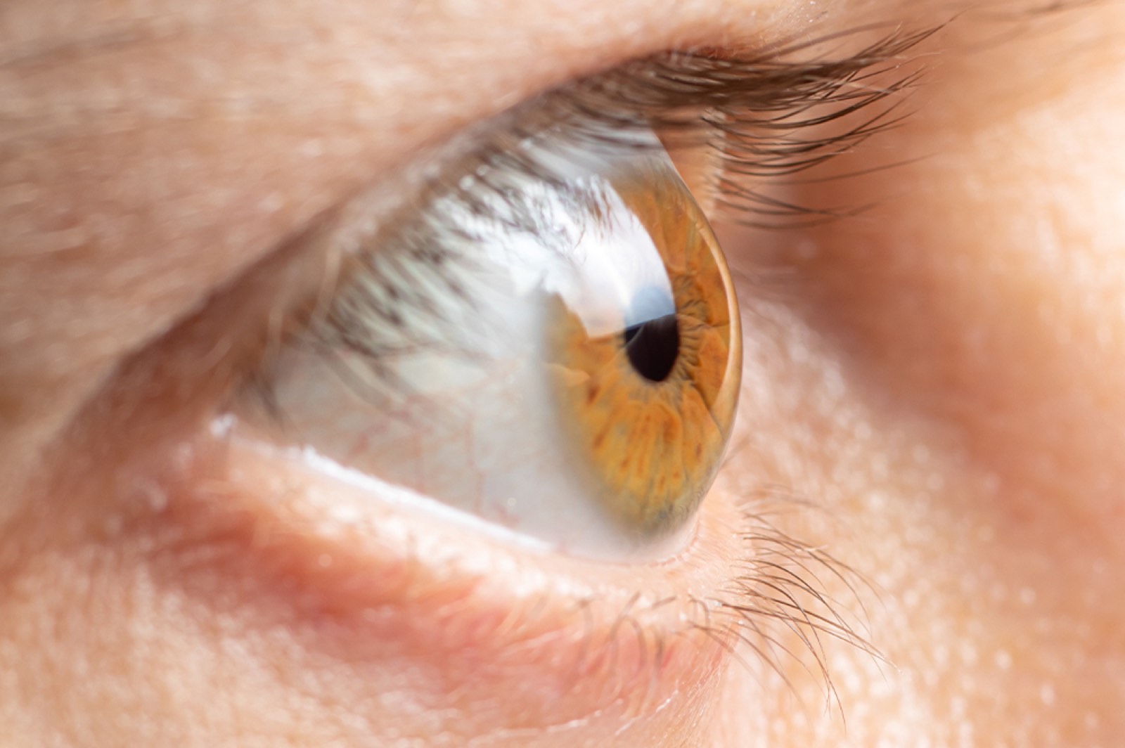 Intraocular Lenses: Envy by B&L
