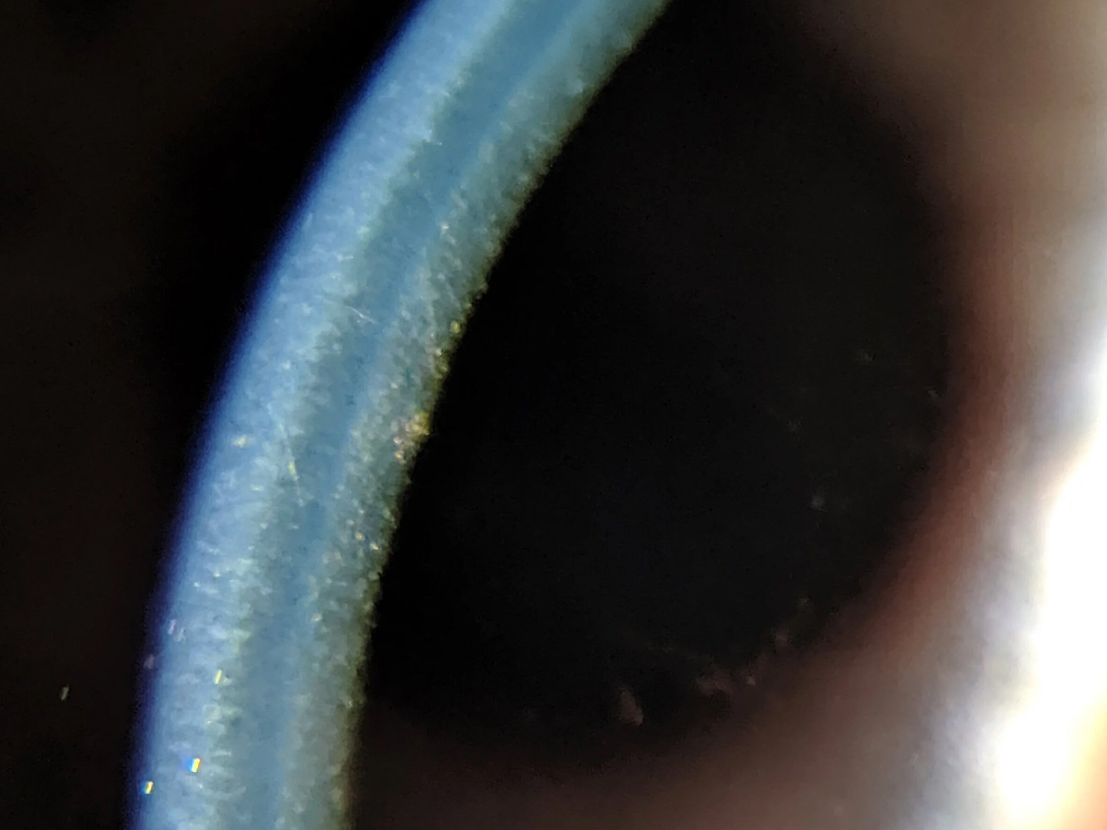 Cataract Surgery with Fuchs' Endothelial Dystrophy: How Surgeons Protect the Cornea